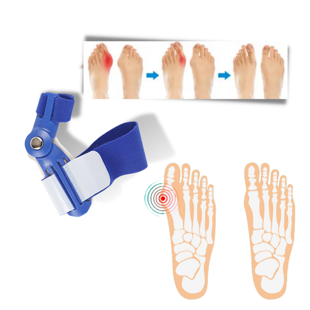 Bunion Relief Orthotic Corrector for Comfortable Foot Alignment