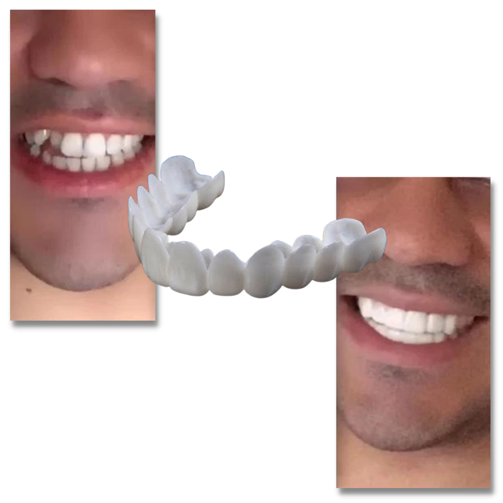 Perfect Smile Dental Coverage: Comfortable, High-Quality Veneers for You
