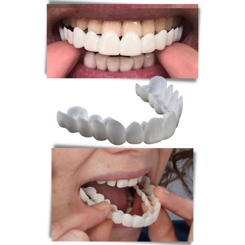 Perfect Smile Dental Coverage: Comfortable, High-Quality Veneers for You