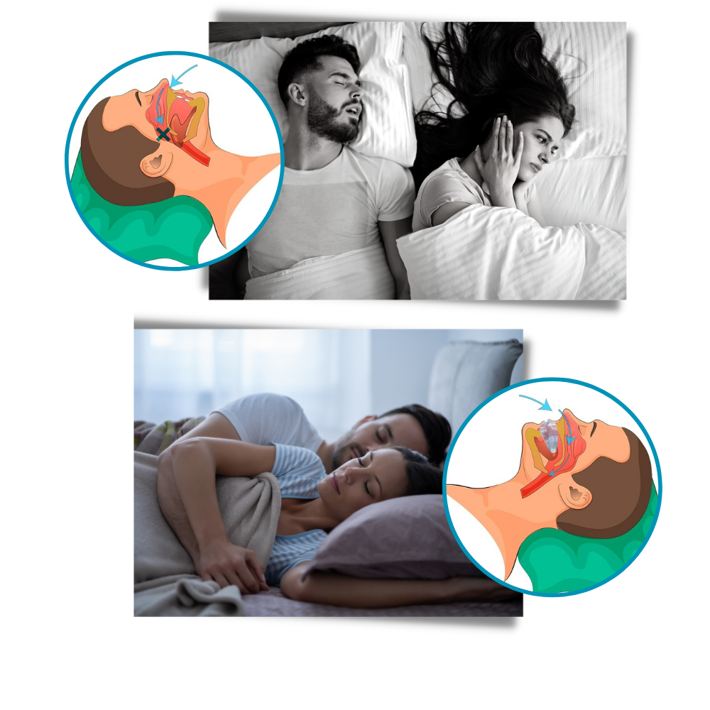 Restful Nights Anti-Snoring Solution for Peaceful Sleep
