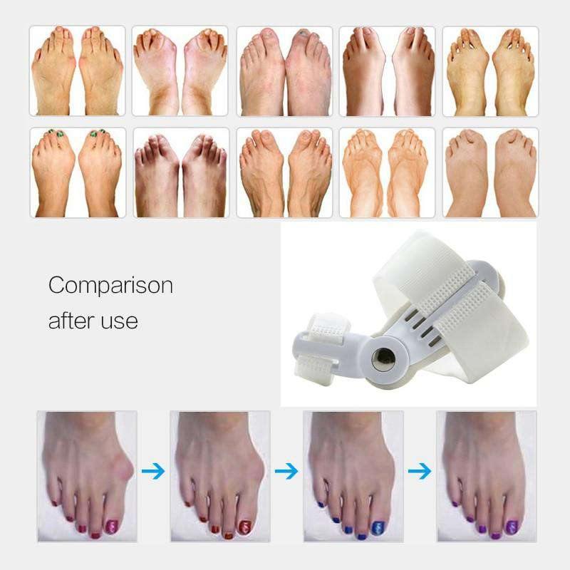 Orthopedic Bunion Corrector - Adjustable Toe Splint Straightener