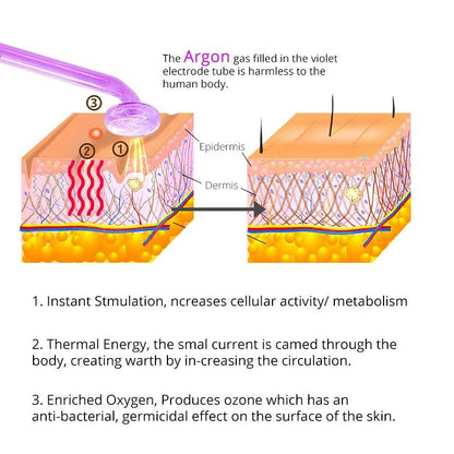 EpiGlow Radiance: Advanced High Frequency Skin Therapy Device