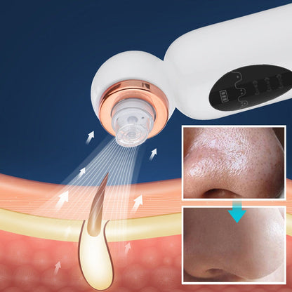 Hydrodermabrasion Blackhead Remover for Clearer, Smoother Skin