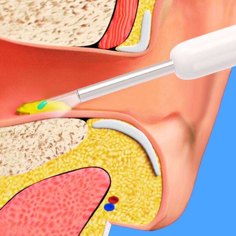 Visual Ear Cleaner With SmartScope Technology For Easy Cleaning