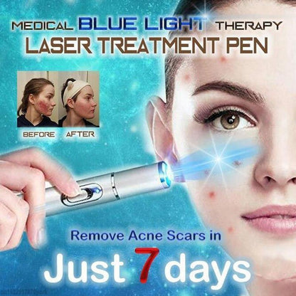 Spider Vein Treatment Pen - Blue Light Laser Therapy Device