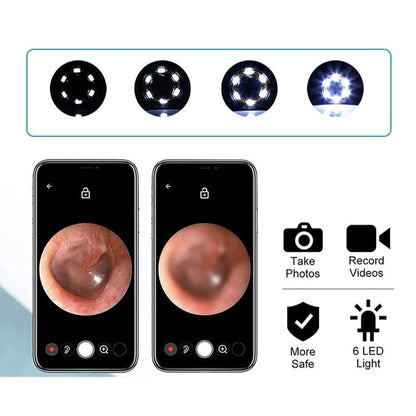 Visual Ear Cleaner With SmartScope Technology For Easy Cleaning