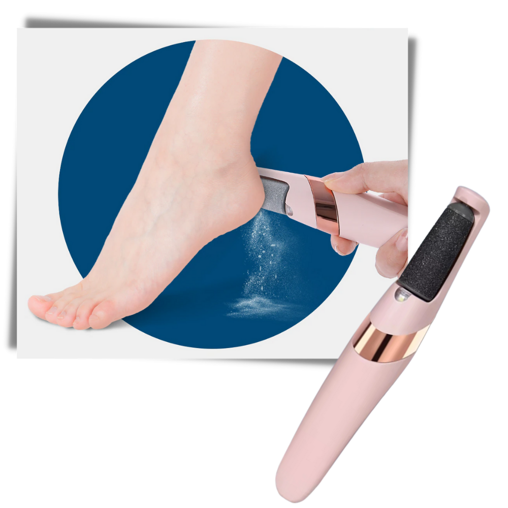 Smooth Feet Electric Callus Remover for Effortless Skin Care