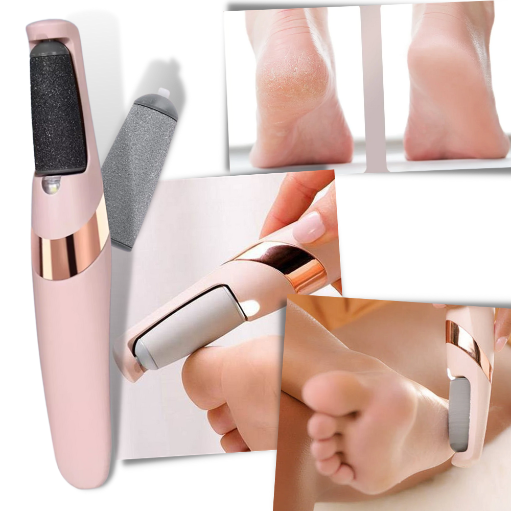 Smooth Feet Electric Callus Remover for Effortless Skin Care