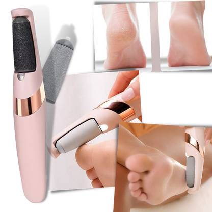 Smooth Feet Electric Callus Remover for Effortless Skin Care