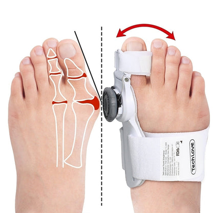 Bunion Relief Solution - 3D Knob Design for Daily Comfort