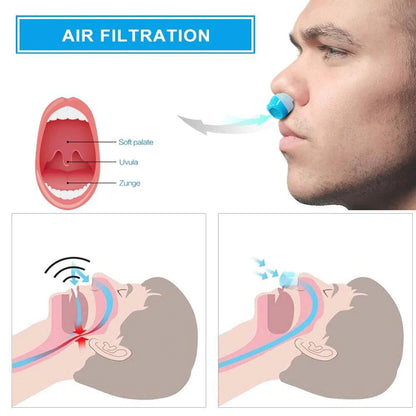 Airing Micro-CPAP Device for Hassle-Free Anti-Snoring Relief