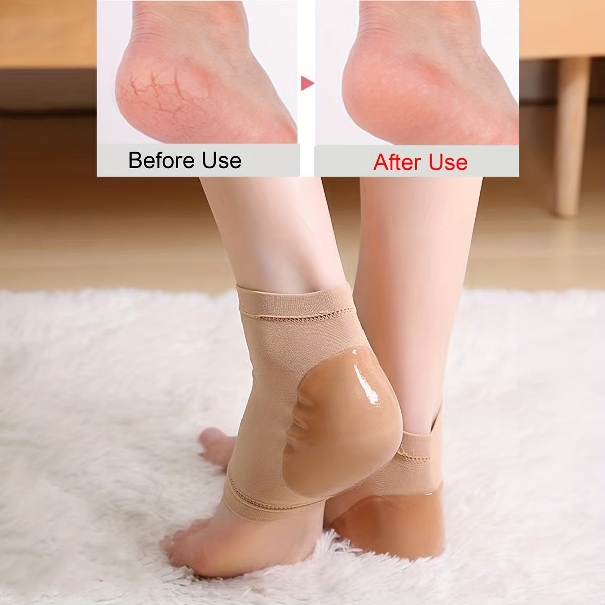 Moisturizing Heel Sleeves For Cracked Heels Relief And Care