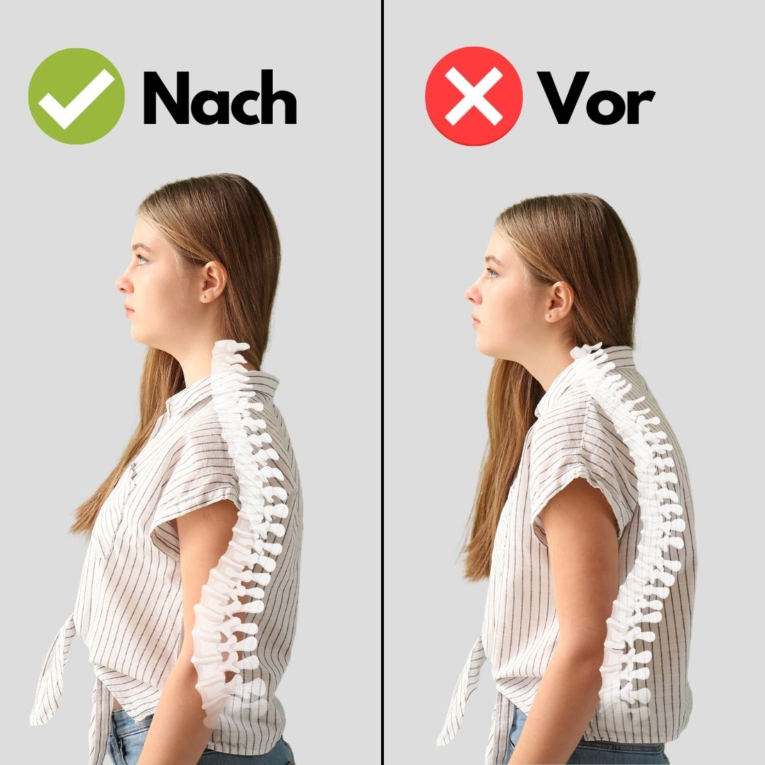 Adjustable Back Posture Corrector for Improved Spine Alignment