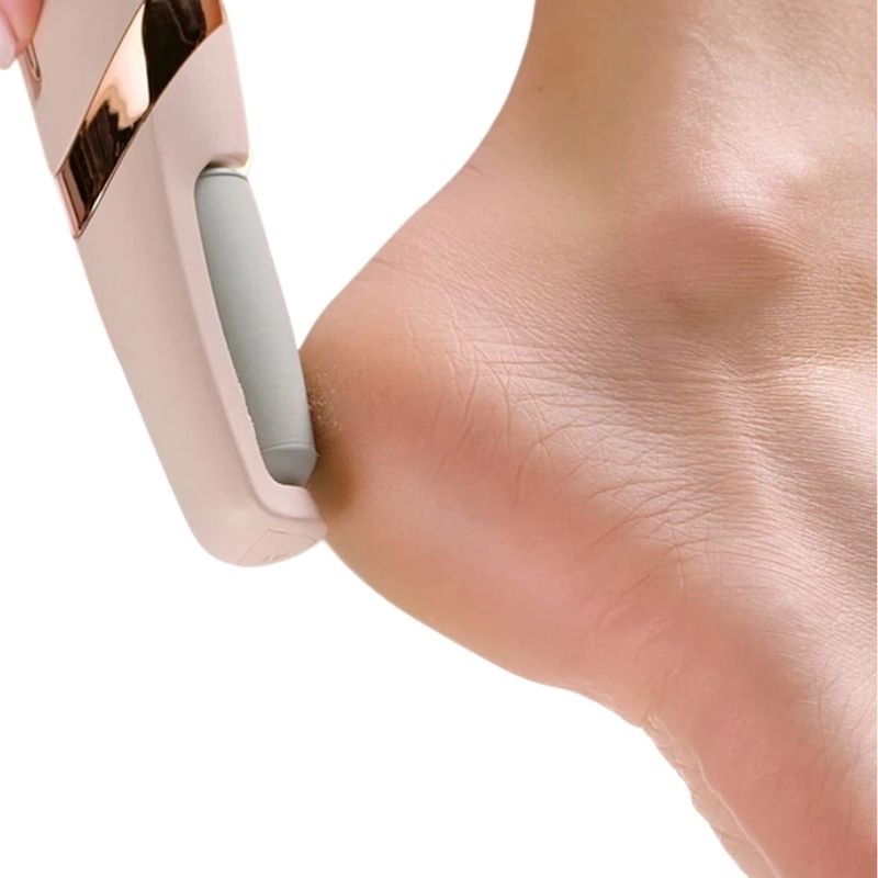 SmoothFeet Pro Electric Callus Remover for Silky Soft Feet