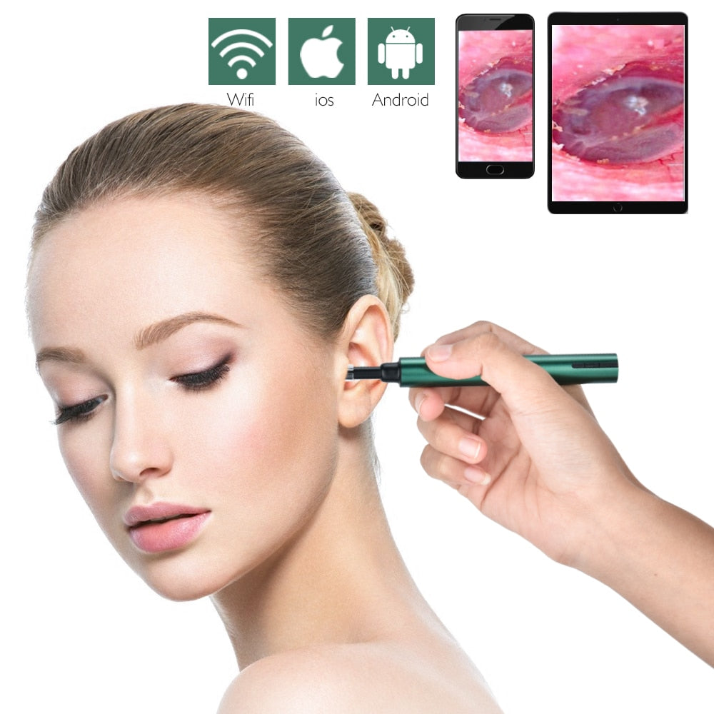 Otoscope Ear Wax Remover For Clearer Hearing And Comfort