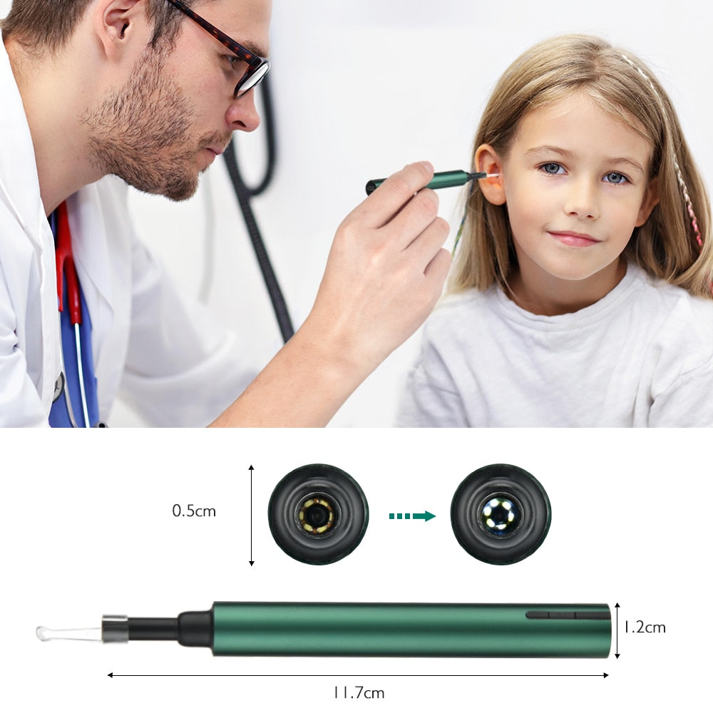 Otoscope Ear Wax Remover For Clearer Hearing And Comfort