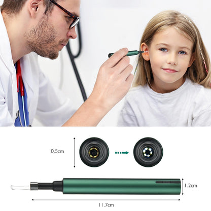 Otoscope Ear Wax Remover For Clearer Hearing And Comfort