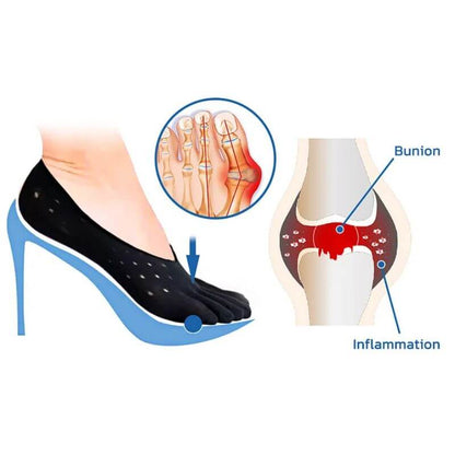 Comfortable Outdoor Socks for Bunion Pain and Stiffness Relief