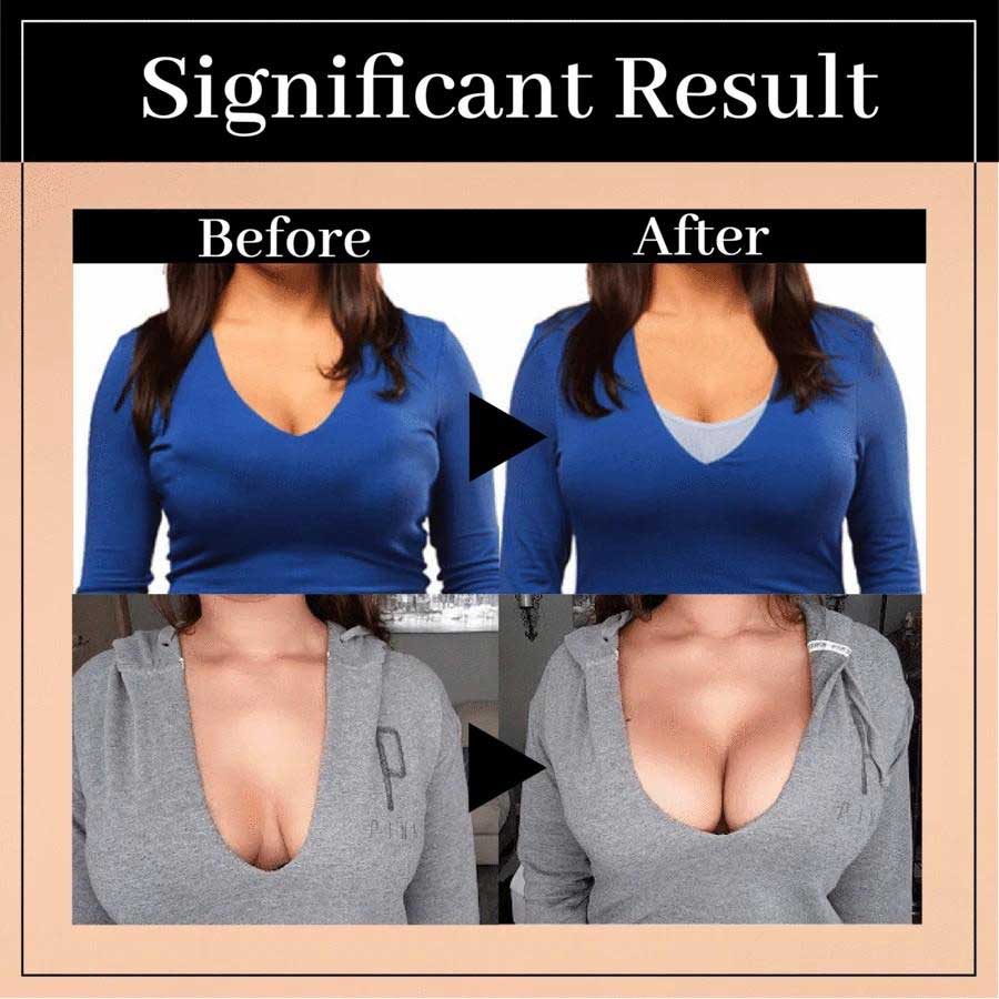 Posture Perfect Wireless Lift Bra for Ultimate Comfort