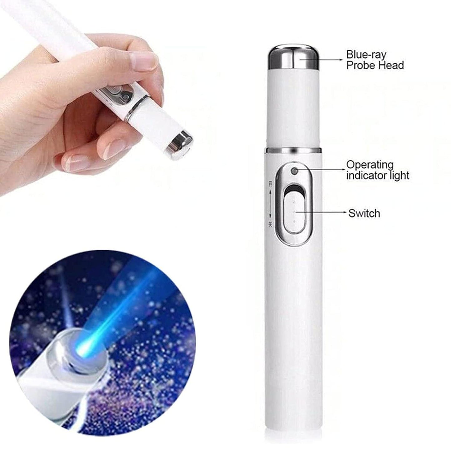 Venous Relief Therapy Pen: Blue Light Treatment for Veins