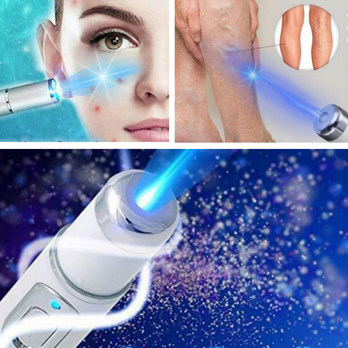 Spider Vein Treatment Pen - Blue Light Laser Therapy Device