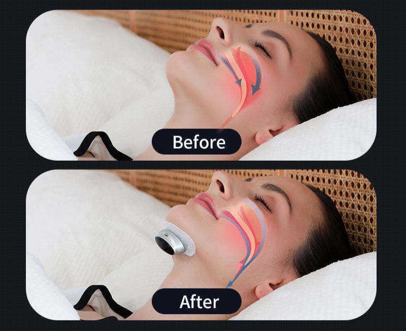 Smart Sleep Apnea Solution for Restful Nights and Better Health