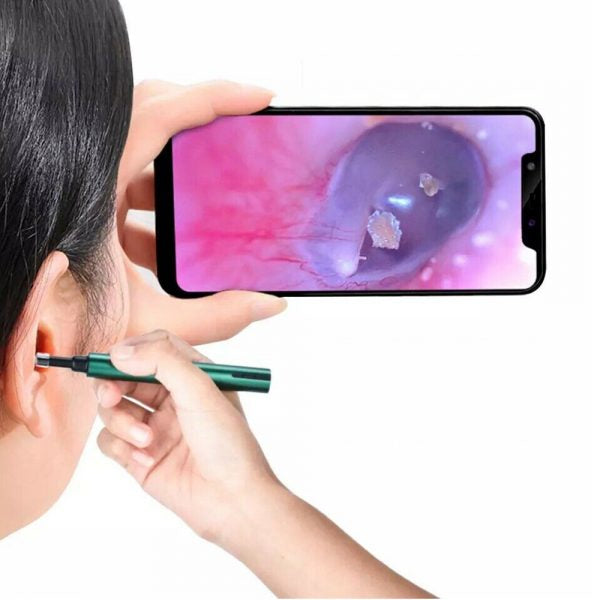 Otoscope Ear Wax Remover For Clearer Hearing And Comfort