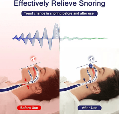 Compact Micro CPAP Device For Travel And Snoring Relief