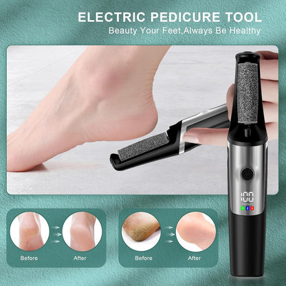 Electric Callus Remover Kit for Smooth, Soft Feet