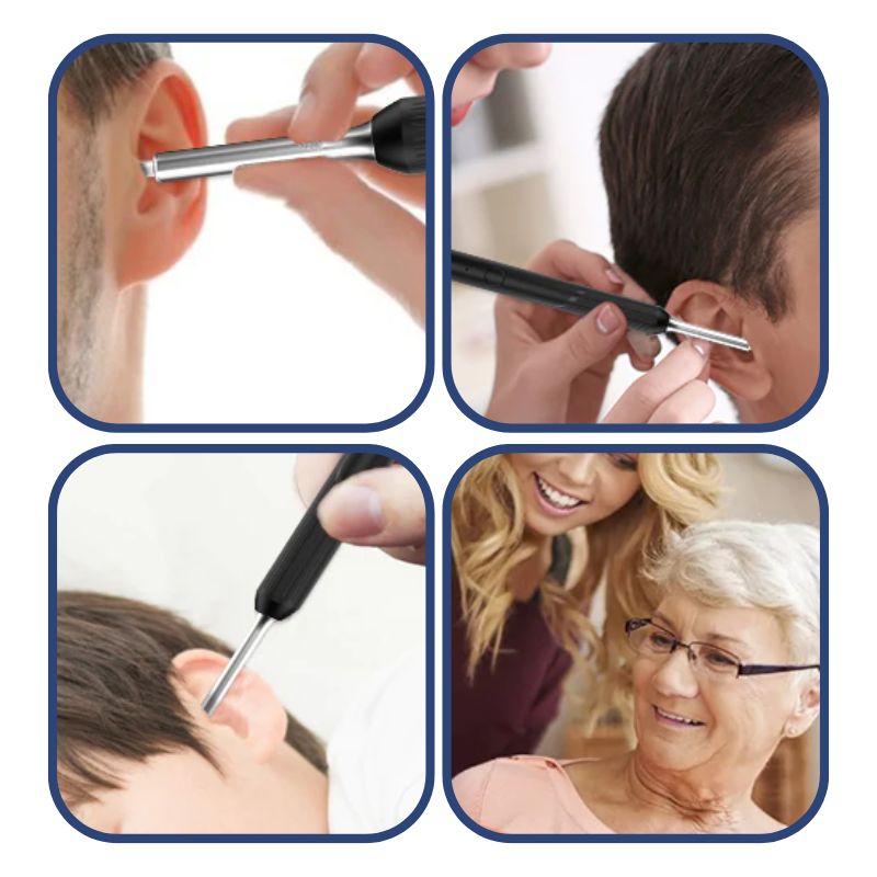 Visual Ear Cleaner With SmartScope Technology For Easy Cleaning