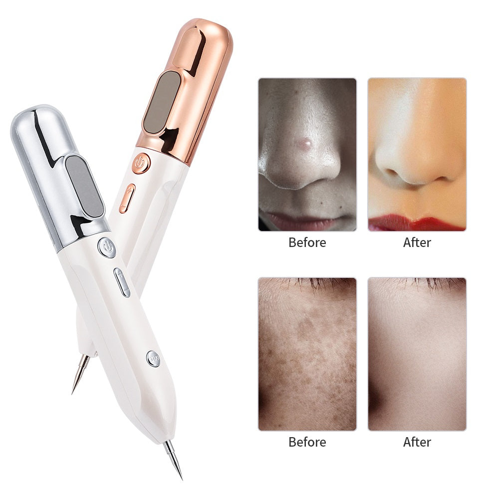 Plasma Pen for Effective Mole and Skin Tag Removal