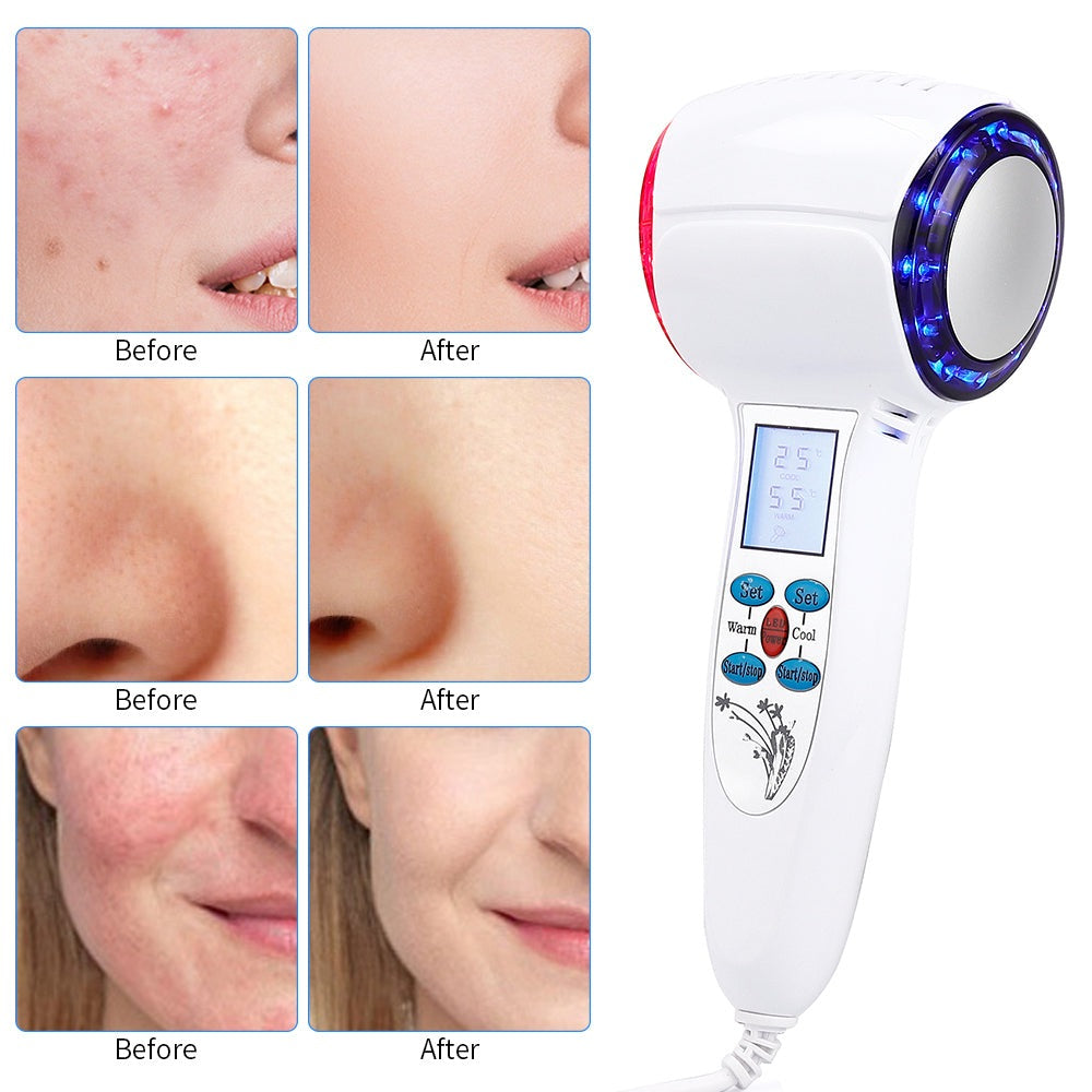 At-Home Facial Cryotherapy Device for Radiant Skin Revitalization