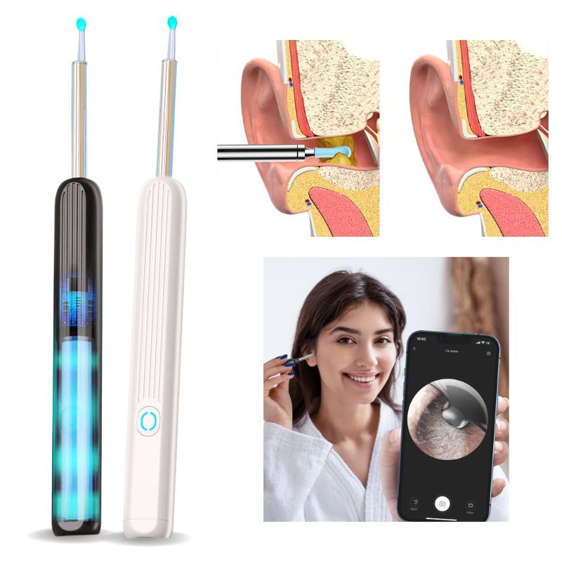 Visual Ear Cleaner With SmartScope Technology For Easy Cleaning