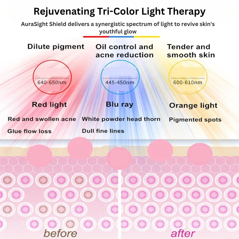 AuraSight Light Therapy Shield: Effective Blemish Treatment Device