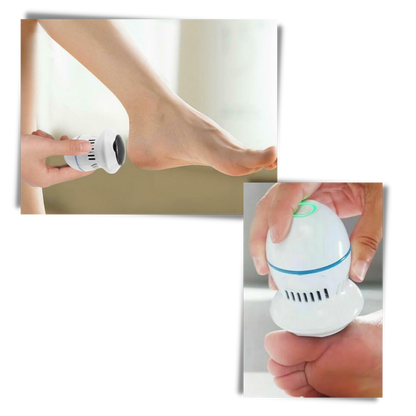 Gentle Feet Electric Callus Remover for Smooth Skin