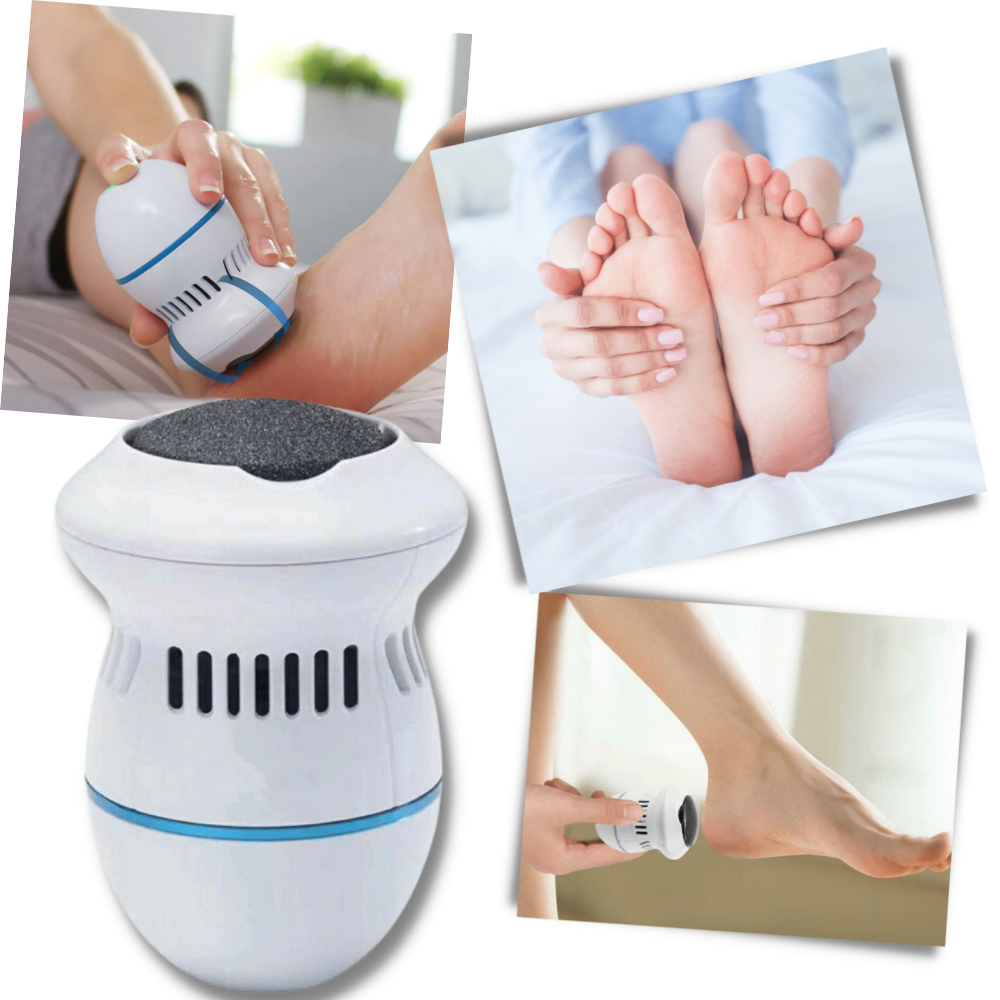 Gentle Feet Electric Callus Remover for Smooth Skin