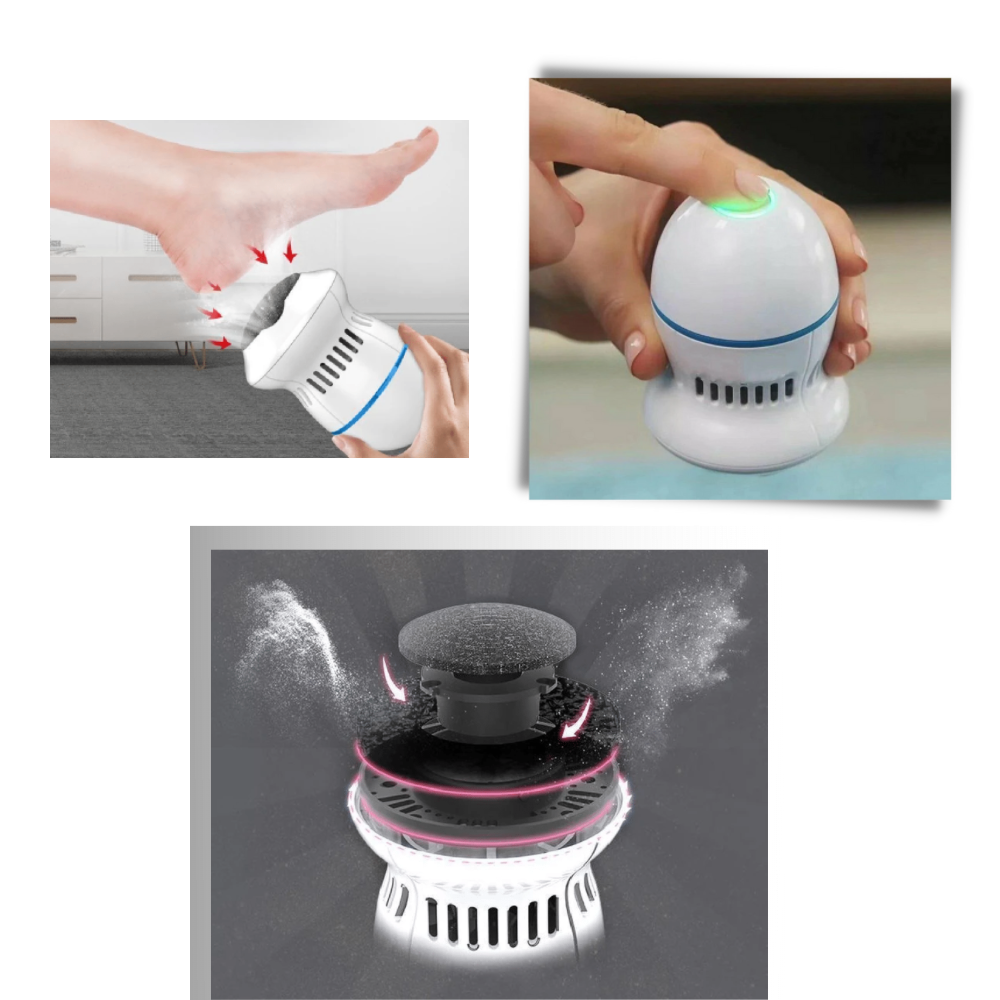 Gentle Feet Electric Callus Remover for Smooth Skin