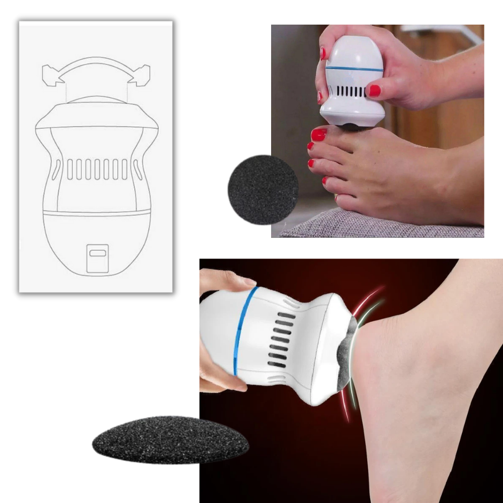 Gentle Feet Electric Callus Remover for Smooth Skin