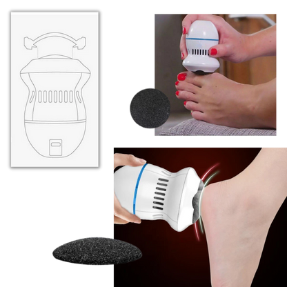 Gentle Feet Electric Callus Remover for Smooth Skin