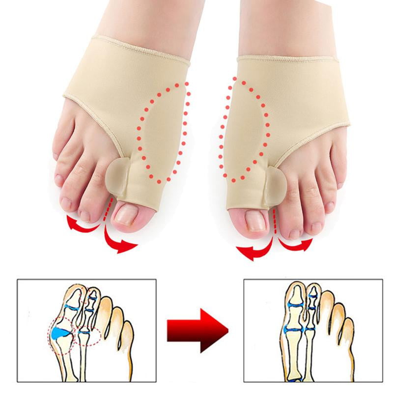 Orthopedic Bunion Corrector Sleeve for Pain Relief (1 Pair)