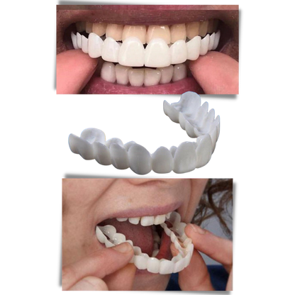 Perfect Smile Dental Coverage: Comfortable, High-Quality Veneers for You