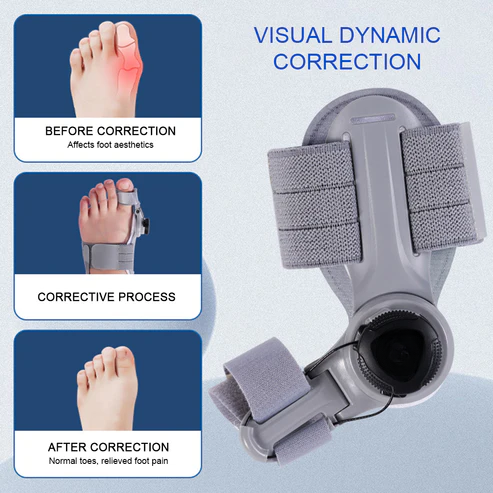 Bunion Relief Corrector for Comfortable Toe Alignment and Support