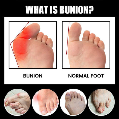 Comfortable Outdoor Socks for Bunion Pain and Stiffness Relief