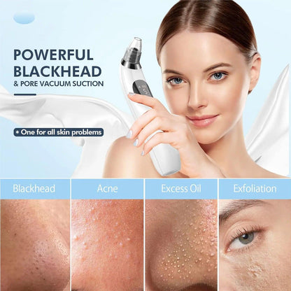 Pore Vacuum Extractor with 5 Probes for Clear Skin