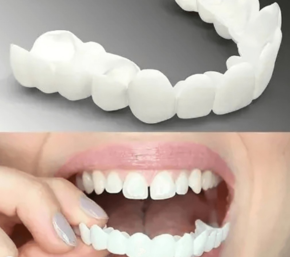 Comfort Fit Adjustable Snap-On Dentures for Easy Wear