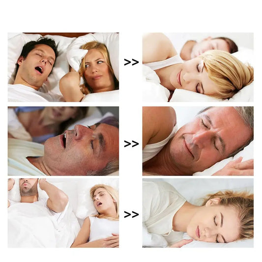 Nasal Strips for Improved Breathing and Sleep Quality - 3 Month Supply