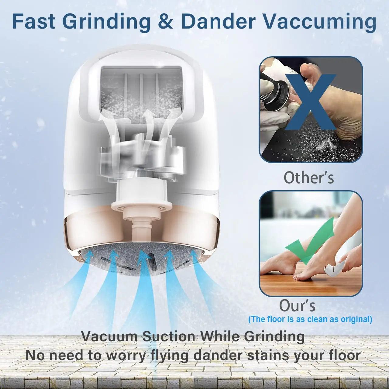 Electric Foot Grinder for Professional Pedicure and Callus Removal