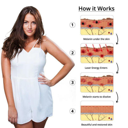 Effective Tattoo Removal Laser For Smooth Skin Restoration