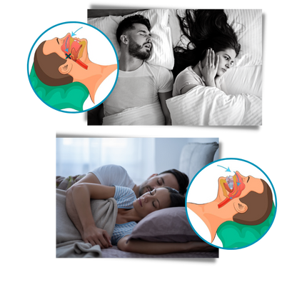 Restful Nights Anti-Snoring Solution for Peaceful Sleep
