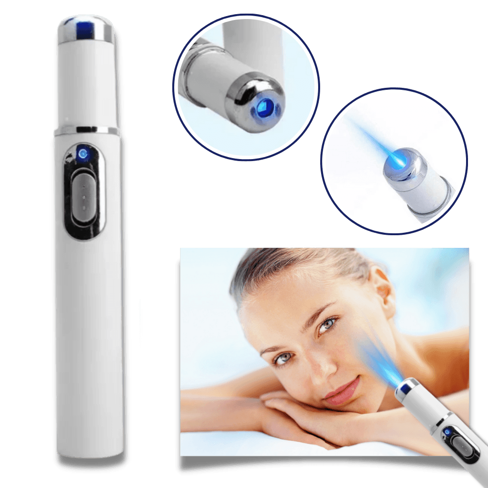 Blue Laser Pen for Effective Dark Spot Removal